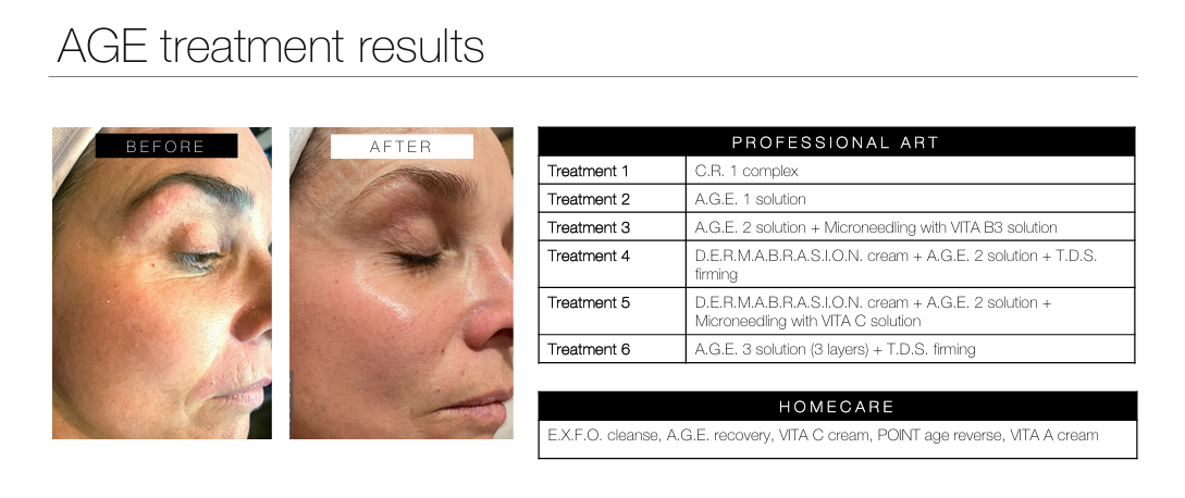 anti-ageing facial results durbanville