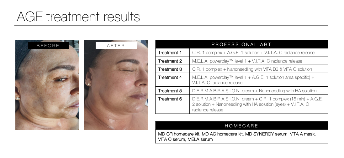 anti-ageing facial results phformula durbanville
