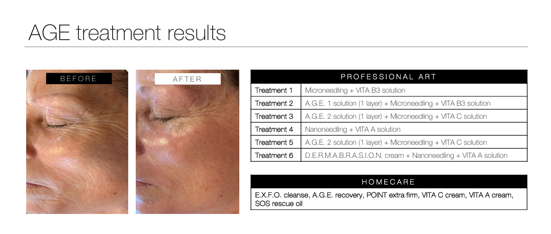 anti-ageing facial results durbanville