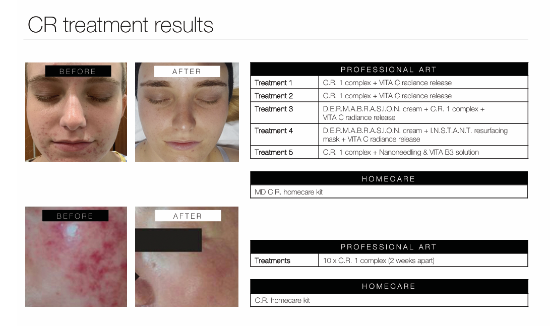 phformula rosacea treatment results durbanville